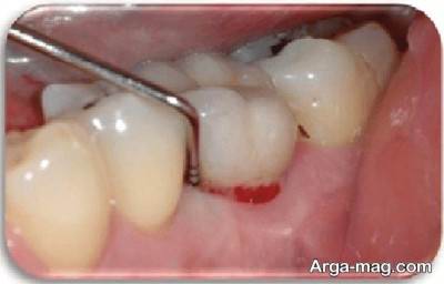 بیماری های دندانی خاص 