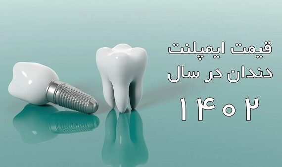 جدید ترین قیمت ایمپلنت دندان در سال 1402