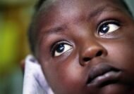 آشنایی با بیماری چشم در کودکان