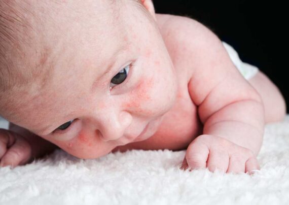 آشنایی با علل ایجاد لکه در چشم نوزاد