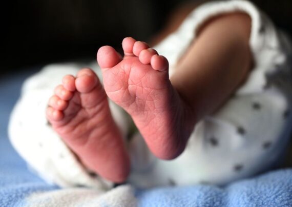 اختلالات ساق پای نوزادان جیست؟