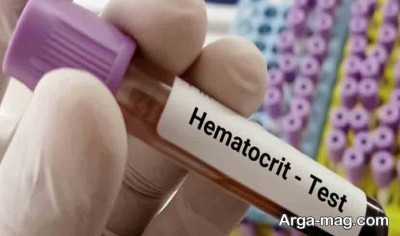 هماتوکریت خون و شمارش سلول های خونی 