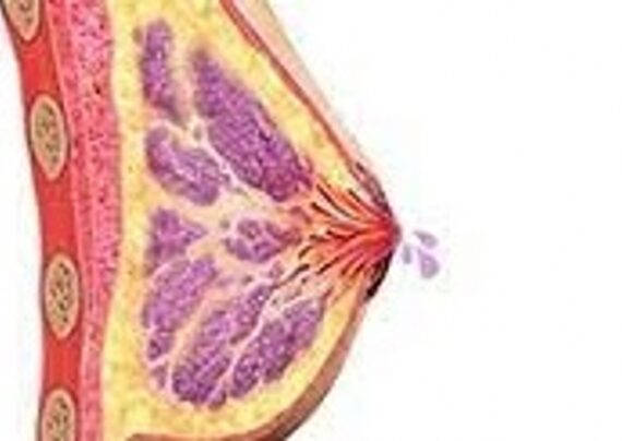 بررسی انواع دلایل ترشخ خونی از نوک پستان