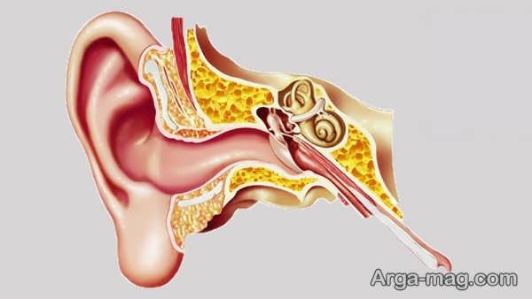کیپ شدن گوش چگونه درمان می شود؟