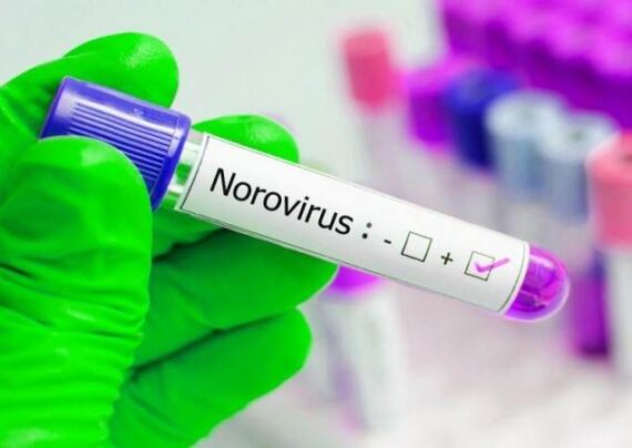 عفونت نوروویروس