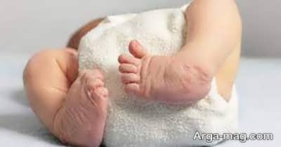 معرفی اختلال پا چنبری