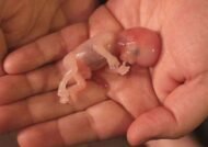 بررسی قانون سقط جنین در ایران