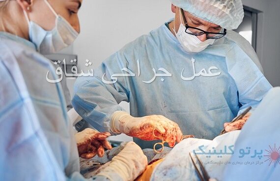 0تا100 عمل جراحی شقاق: آمادگی تا مراقبت های بعد از عمل