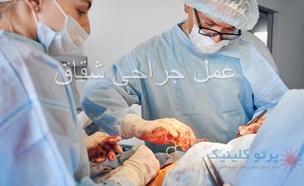 0تا100 عمل جراحی شقاق: آمادگی تا مراقبت های بعد از عمل