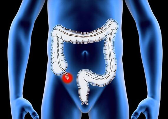 التهاب اپاندیس دختر 2 ساله در اثر بلعیدن پیچ 8 میلی متری!