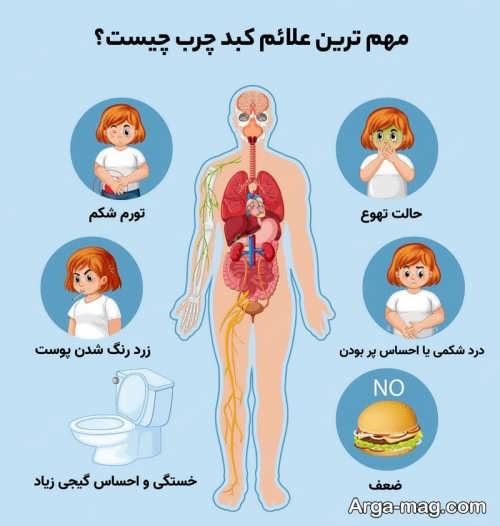 علل و عوارض و درمان کبد چرب در کودکان