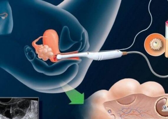 علت ها و دلایل ناموفق بودن ivf