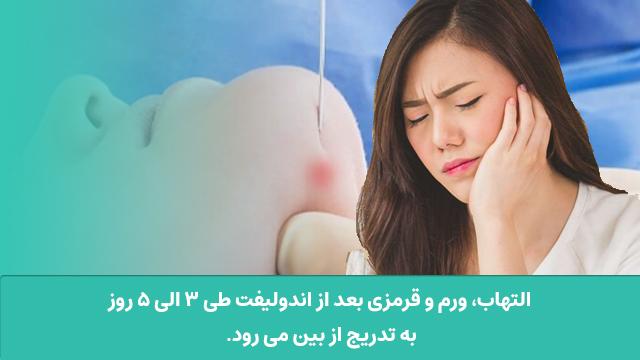 آیا اندولیفت درد دارد؟