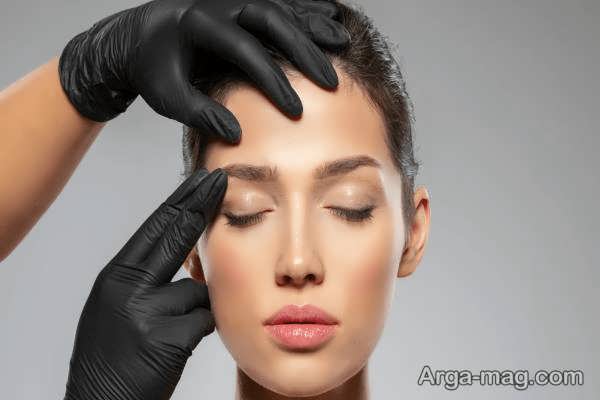 پیامدهای لیفت شقیقه
