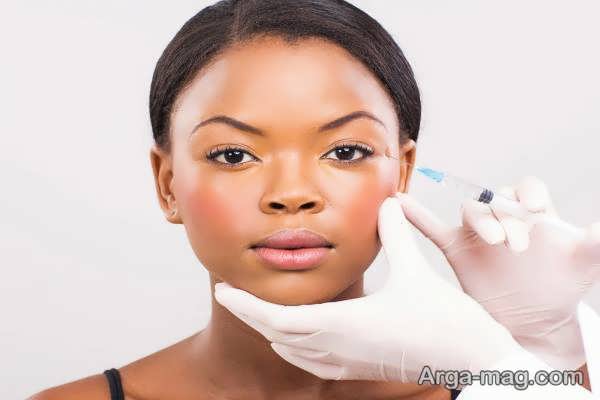 عوارض احتمالی لیفت شقیقه