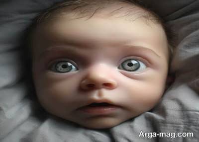 تغییرات رنگ چشم در نوزادان تا 6 ماهگی