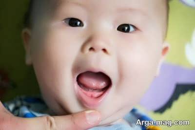 تغییر چهره کودک در سال های اول زندگی