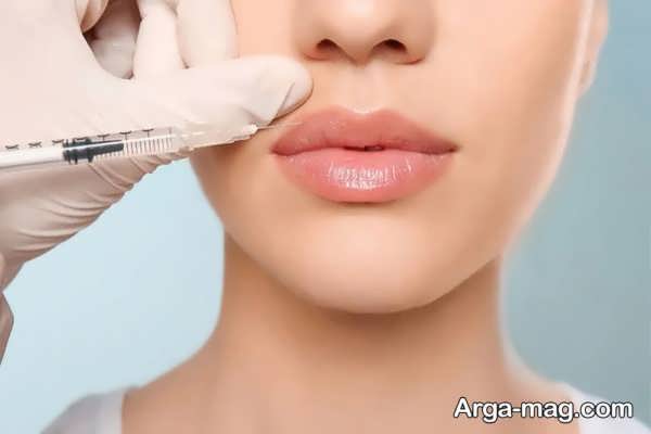 راه های رفع ورم بعد از تزریق ژل لب