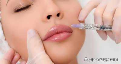  تفاوت تزریق فیلر و ژل
