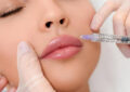 آشنایی با تفاوت تزریق فیلر و ژل