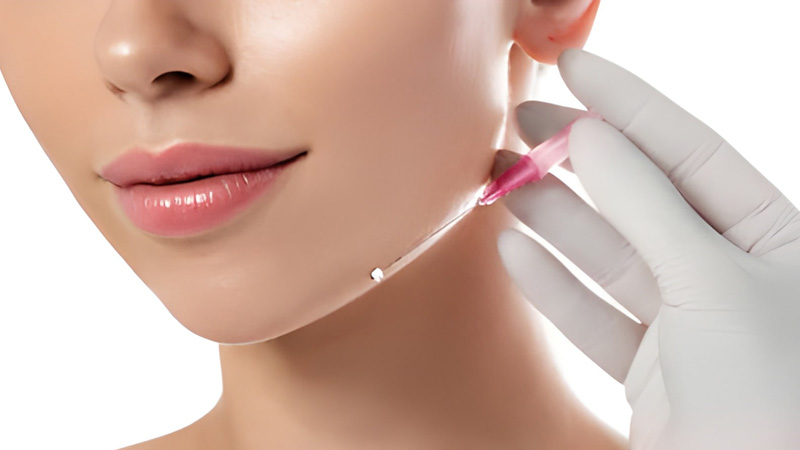 لیفت با نخ برای چه سنینی مناسب است؟ قبل از 30 سالگی یا بعد از 40؟
