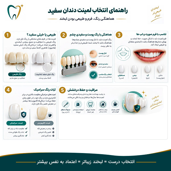 راهنمای انتخاب لمینیت دندان سفید